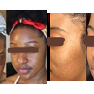 Crème visage vitamine C, 50 ml